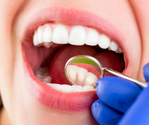 Geelong dental examination on woman with white teeth.